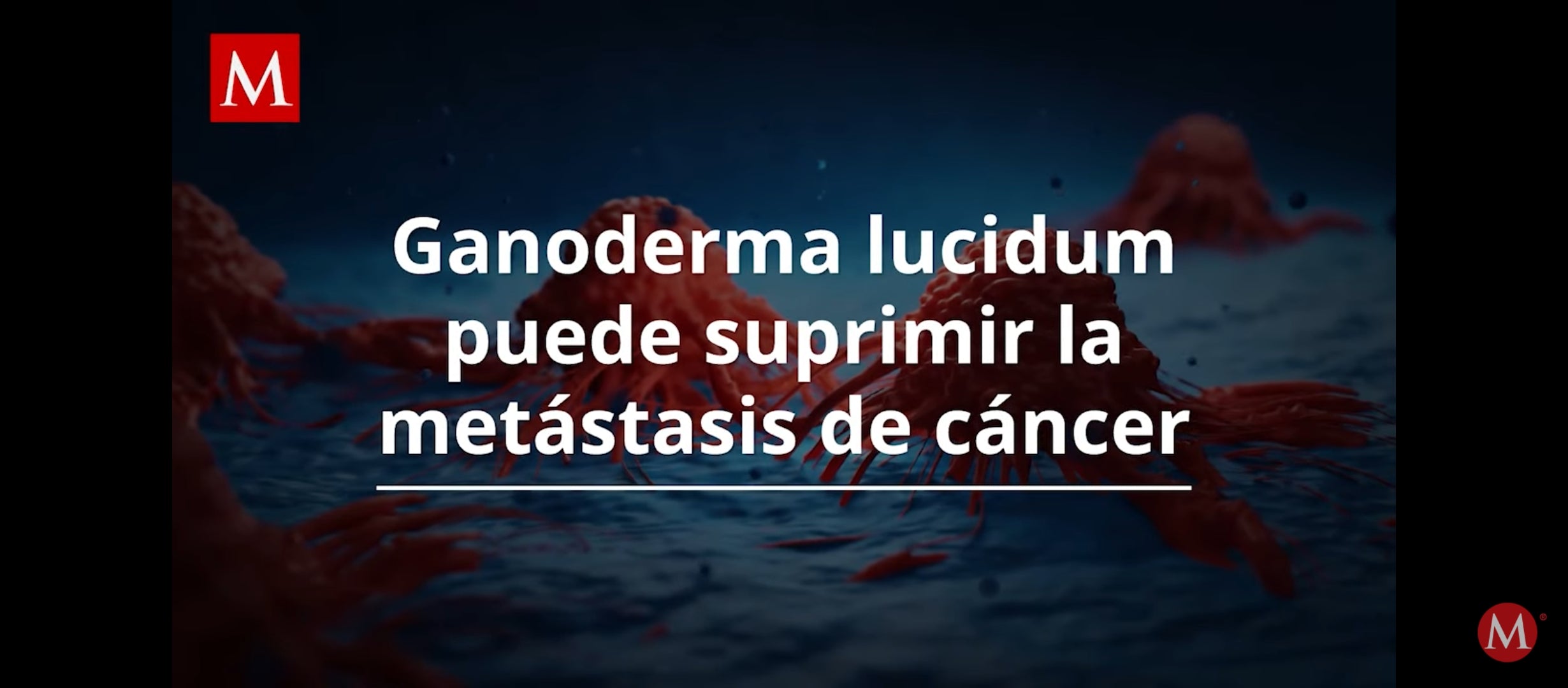 Cargar video: 